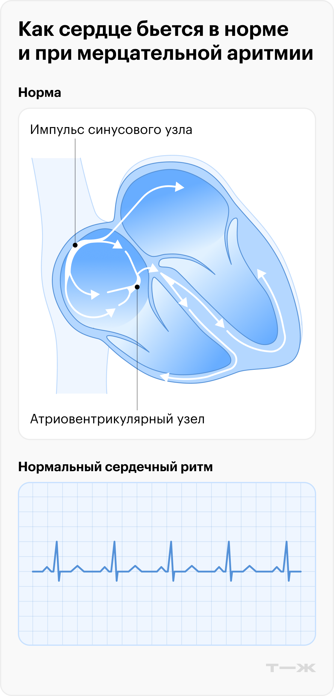 Анализ крови на протромбиновый индекс (МНО)