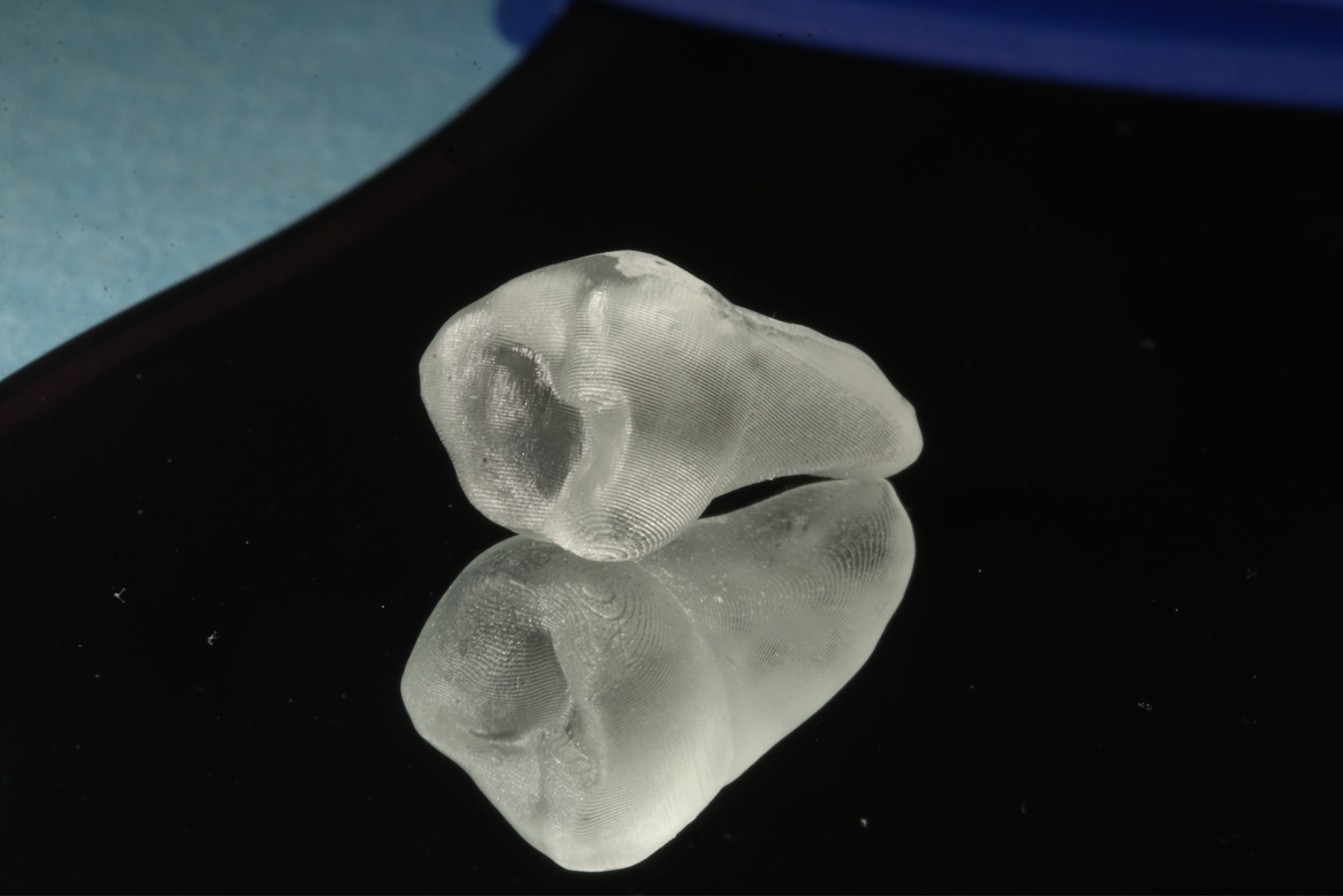 Так выглядит 3D-модель донорского зуба