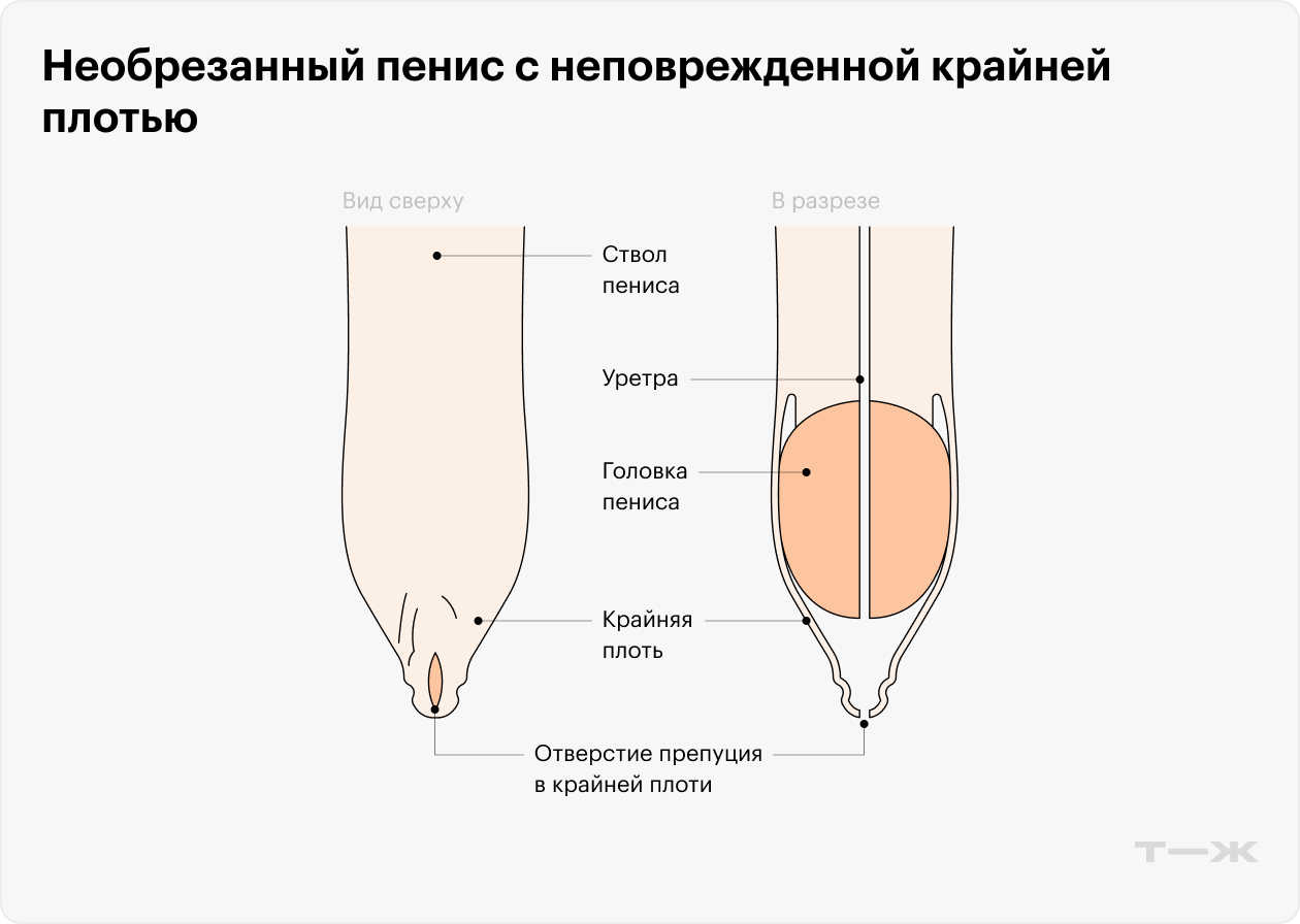 Между головкой члена и крайней плотью есть пространство, в котором поддерживается влажная среда