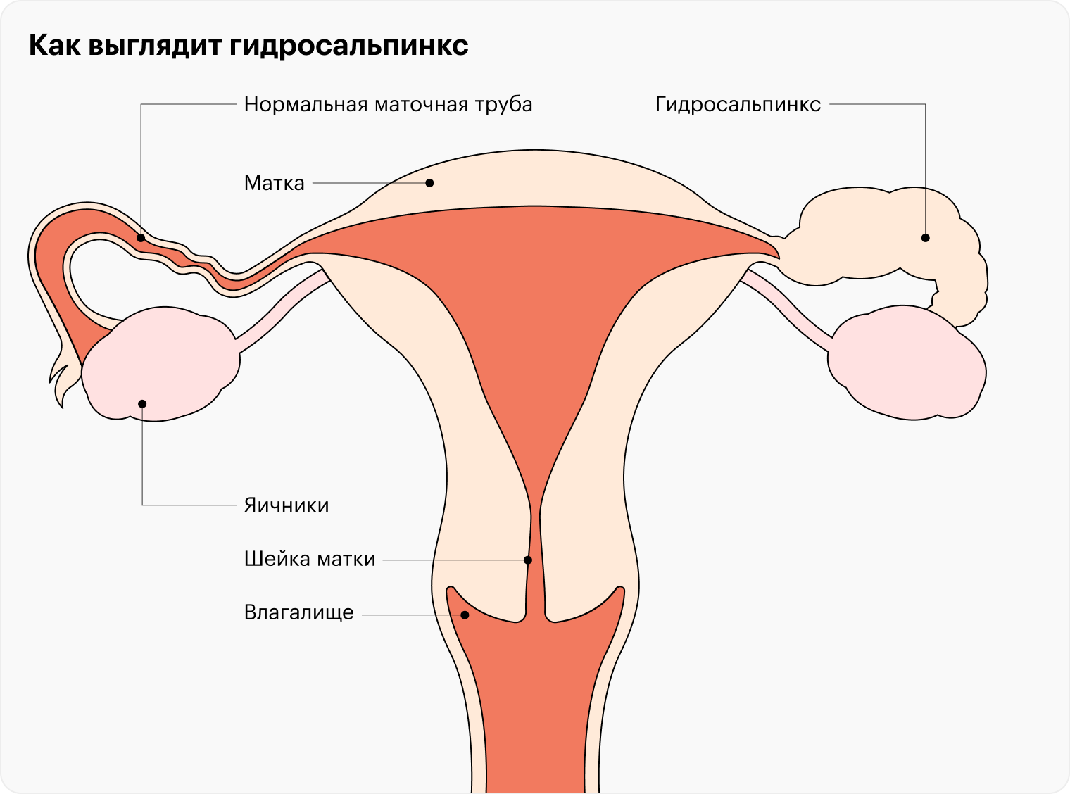 мастурбации и бесплодие у женщин фото 12
