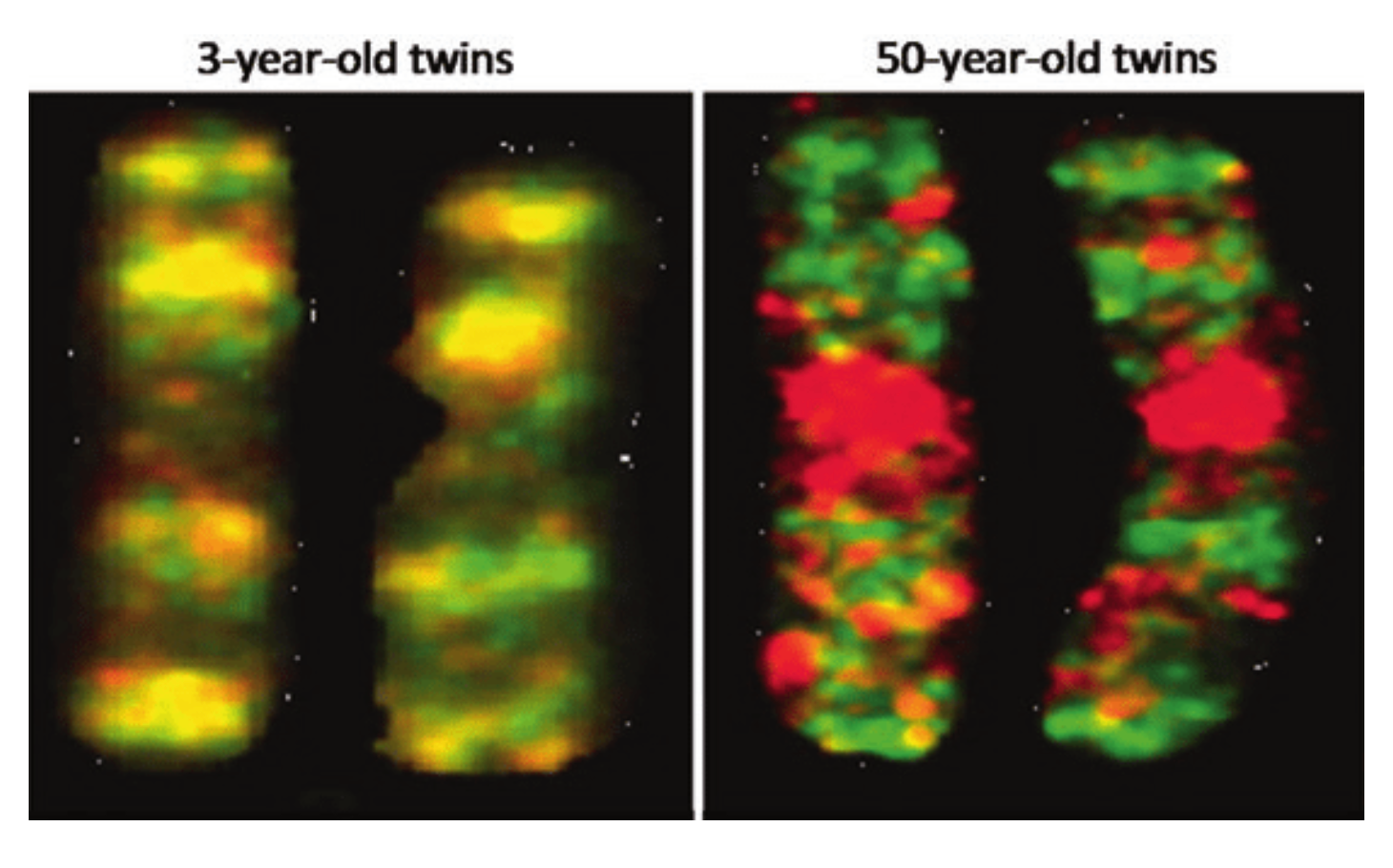Сравнение хромосом близнецов в три года и в 50 лет. Источник: researchgate.net