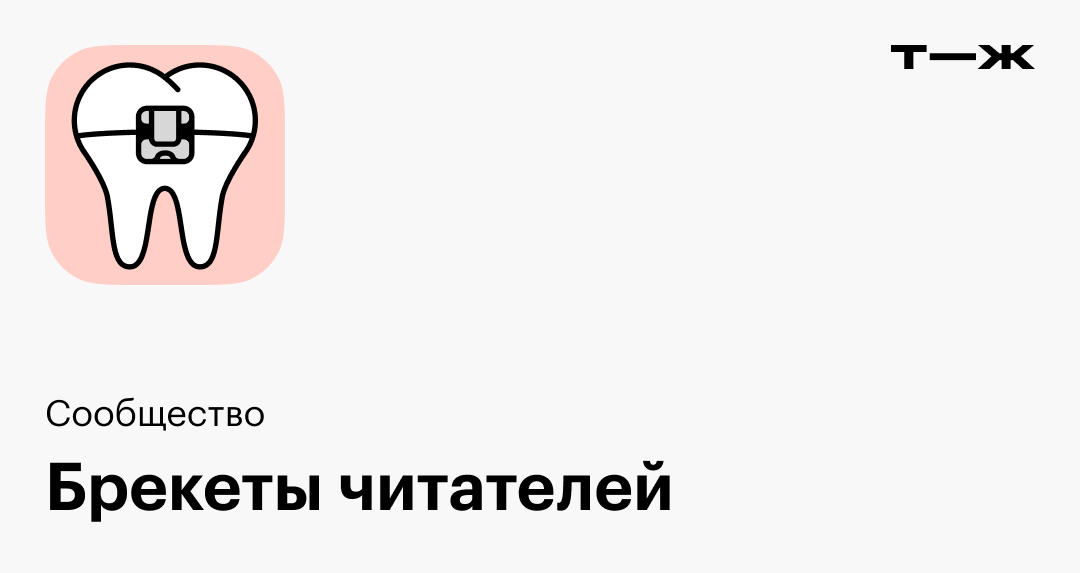 Как я поставила брекеты в 37 лет и носила их 1 год и 10 месяцев