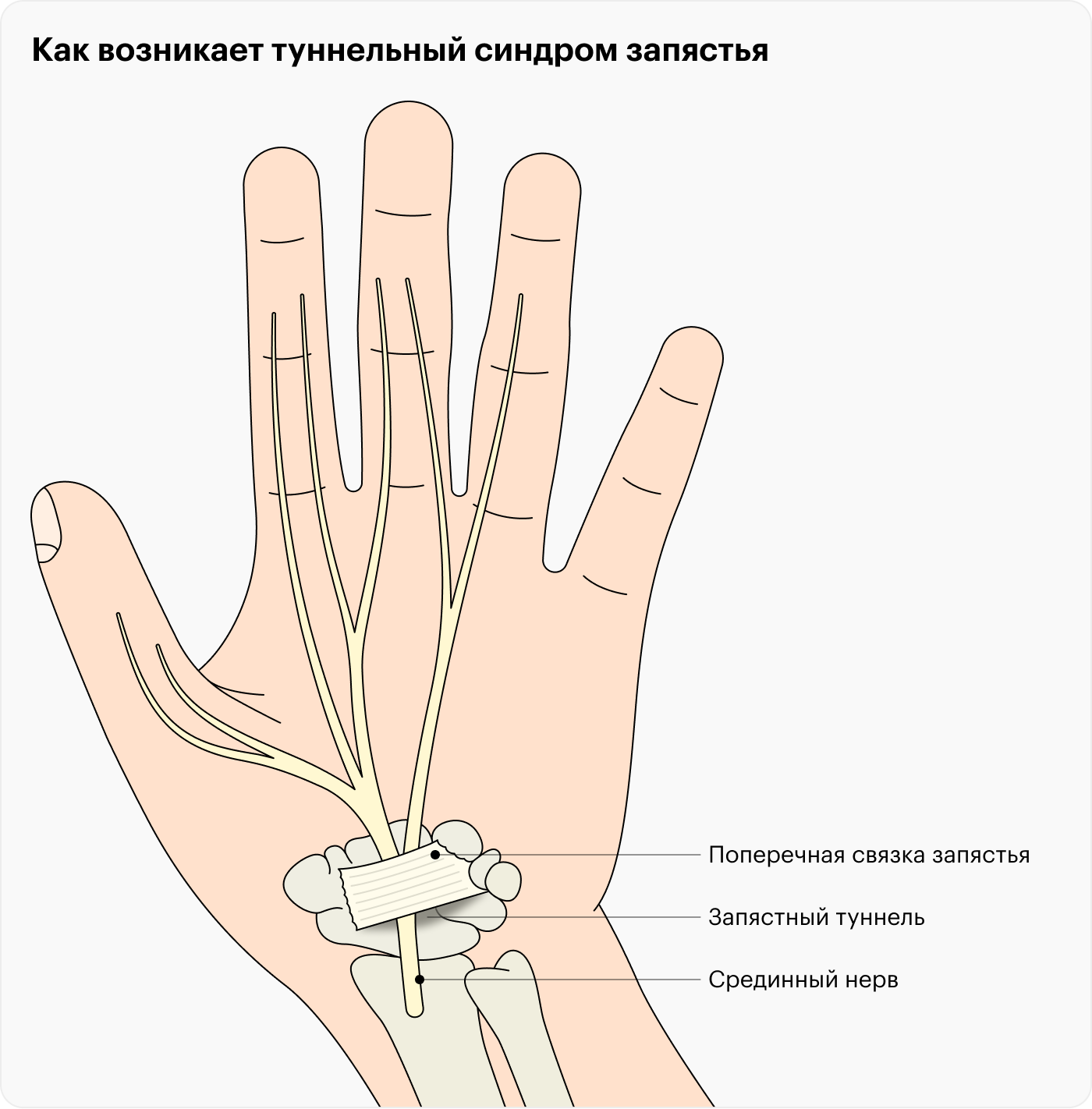 Лечение онемения пальцев рук | Медицинская клиника в Санкт-Петербурге