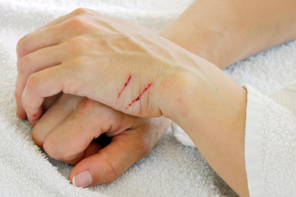 Современный подорожник: как лечить ссадины и раны на коже?