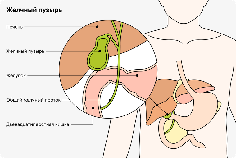 Лечение заболеваний желчного пузыря и его протоков