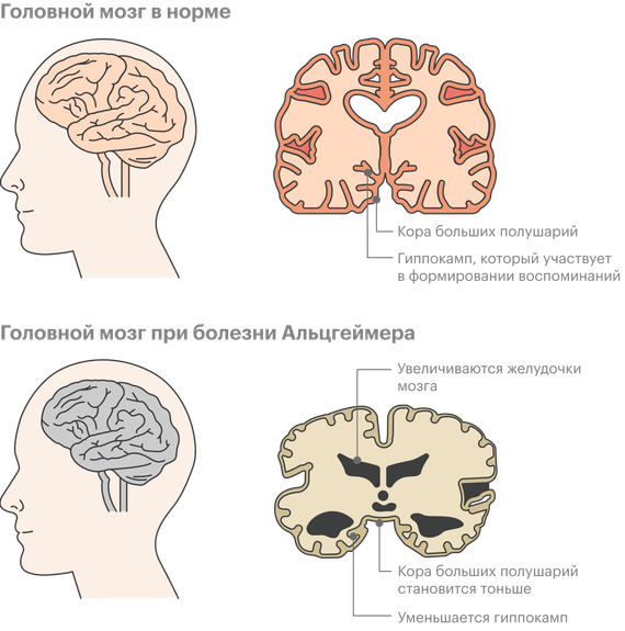 Как узнать свои особые вариации гена?