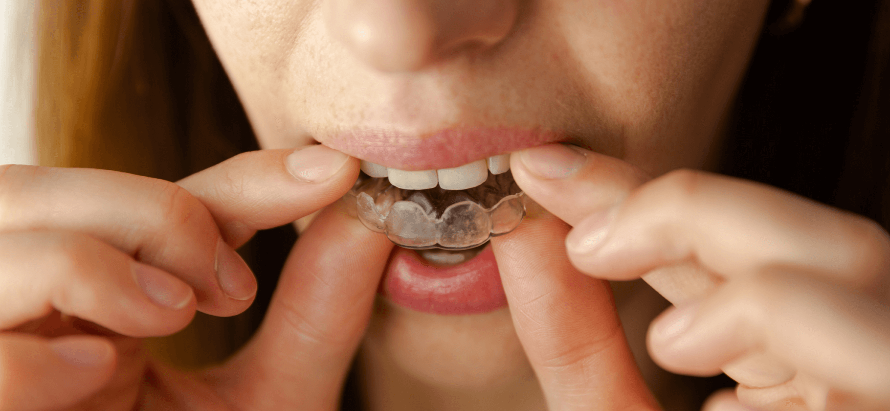 Не только кариес: 5 проблем, с которыми поможет справиться стоматолог