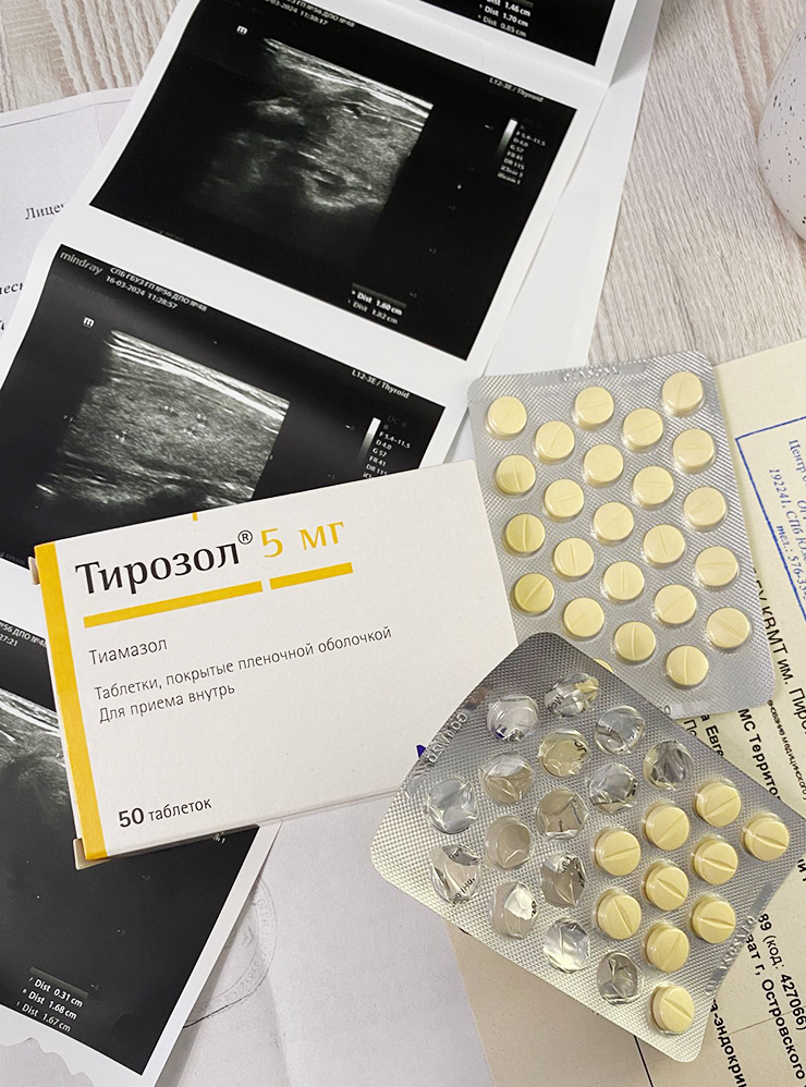 Сейчас принимаю поддерживающую дозу «Тирозола» — 5 мг в сутки