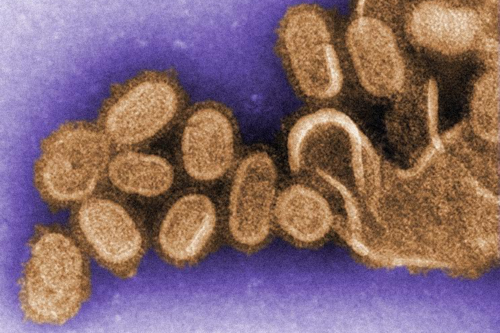 Вирусы свиного гриппа под микроскопом. Источник: emedicine.medscape.com