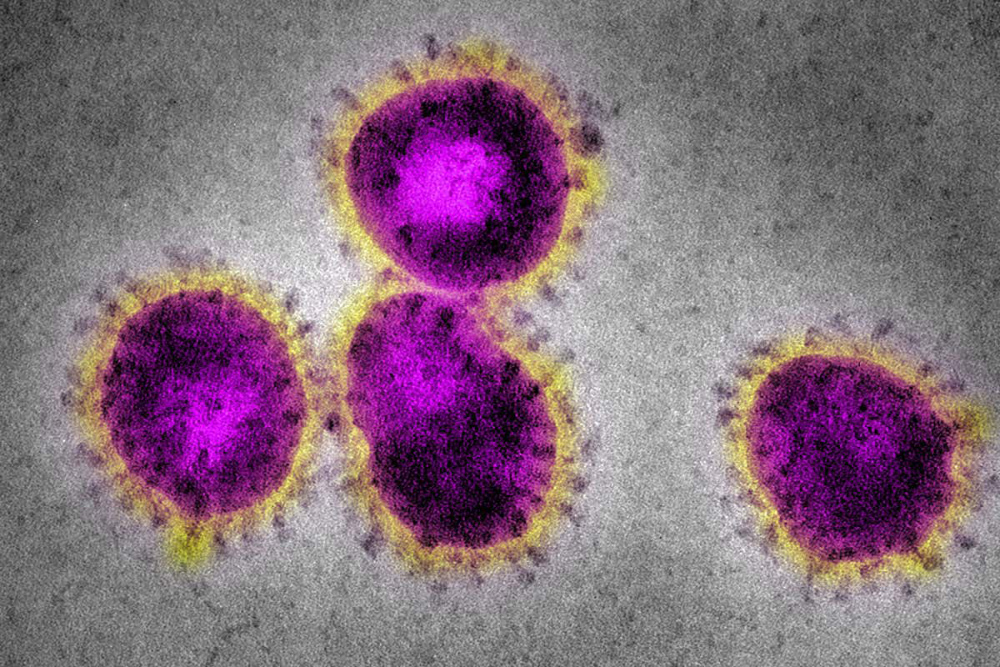 Фото вируса SARS под электронным микроскопом. Источник: newscientist.com