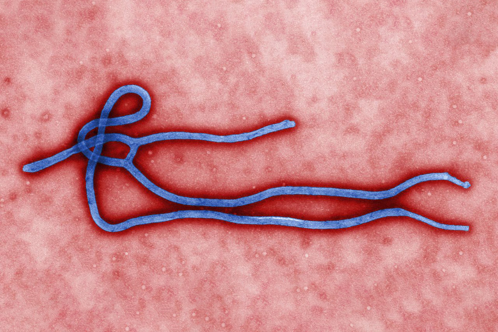 Вирус Эбола совсем не похож на вирусы гриппа или коронавирусы. Источник: wikimedia.org