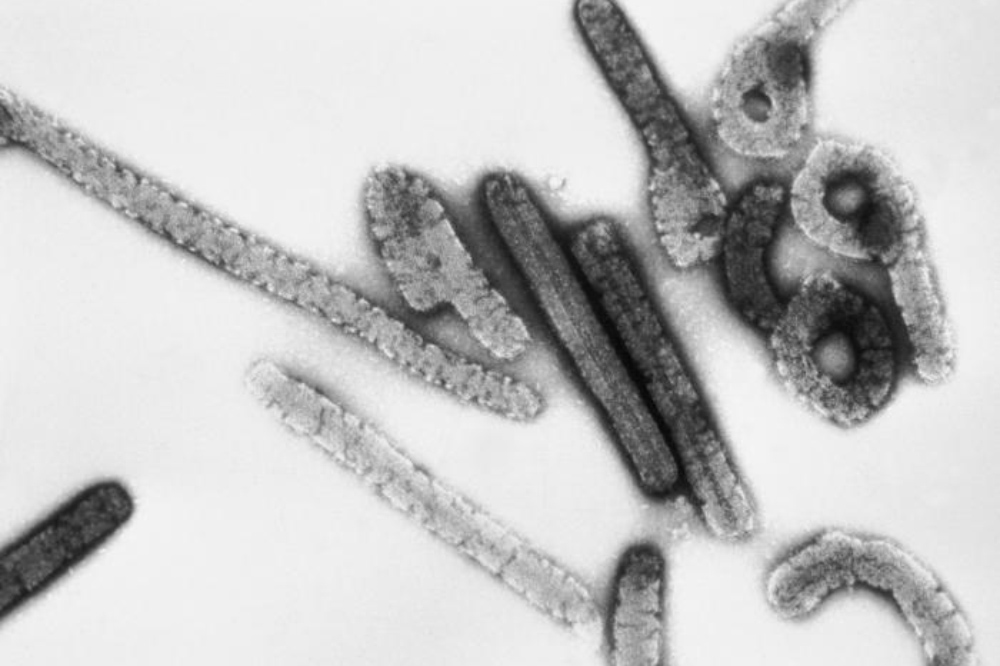 Смертоносный вирус лихорадки Марбург. Источник: wikimedia.org