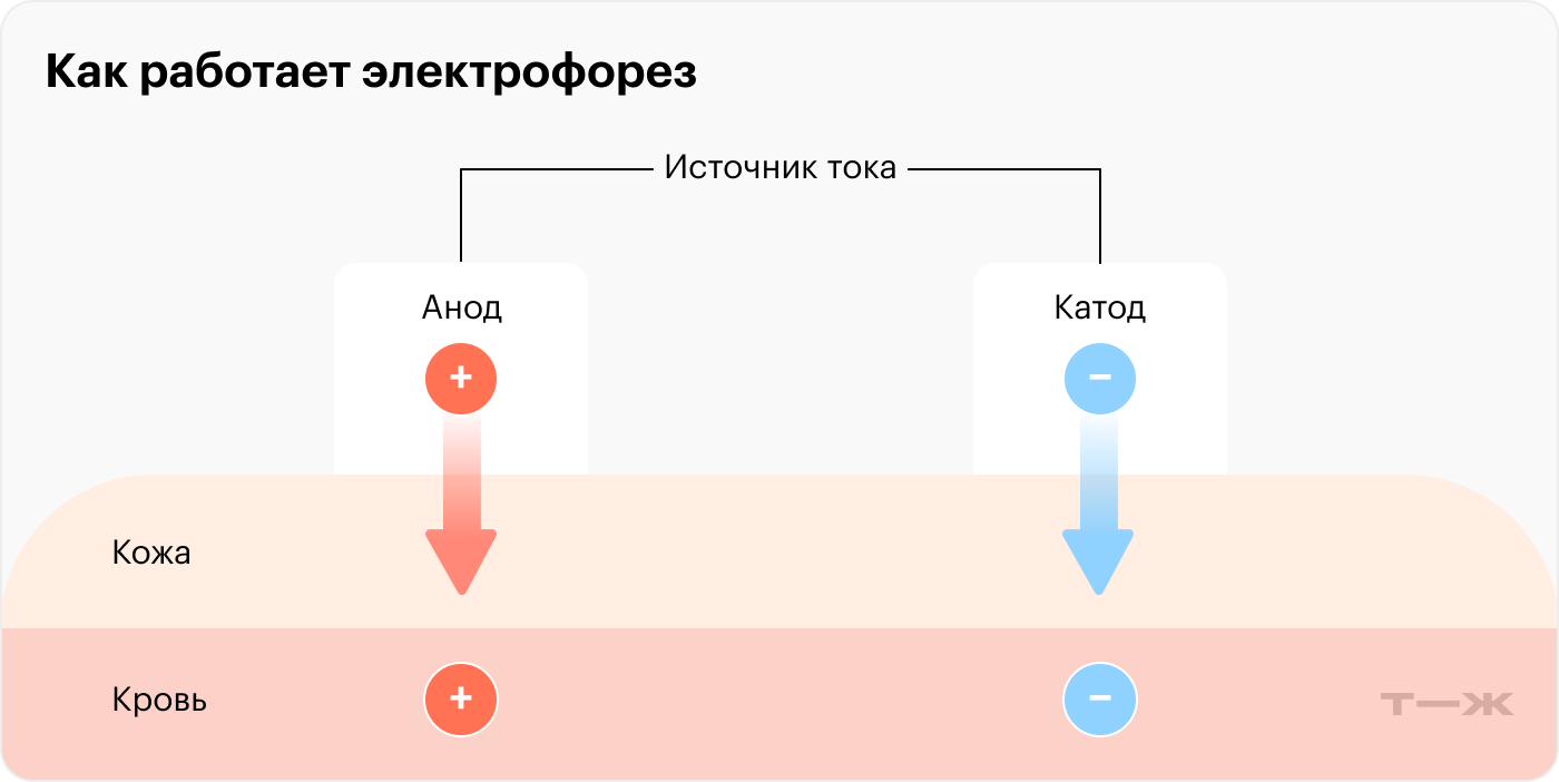 Упрощенная схема электрофореза: положительно заряженные ионы отталкиваются от анода, а отрицательно заряженные — от катода и проходят в кожу