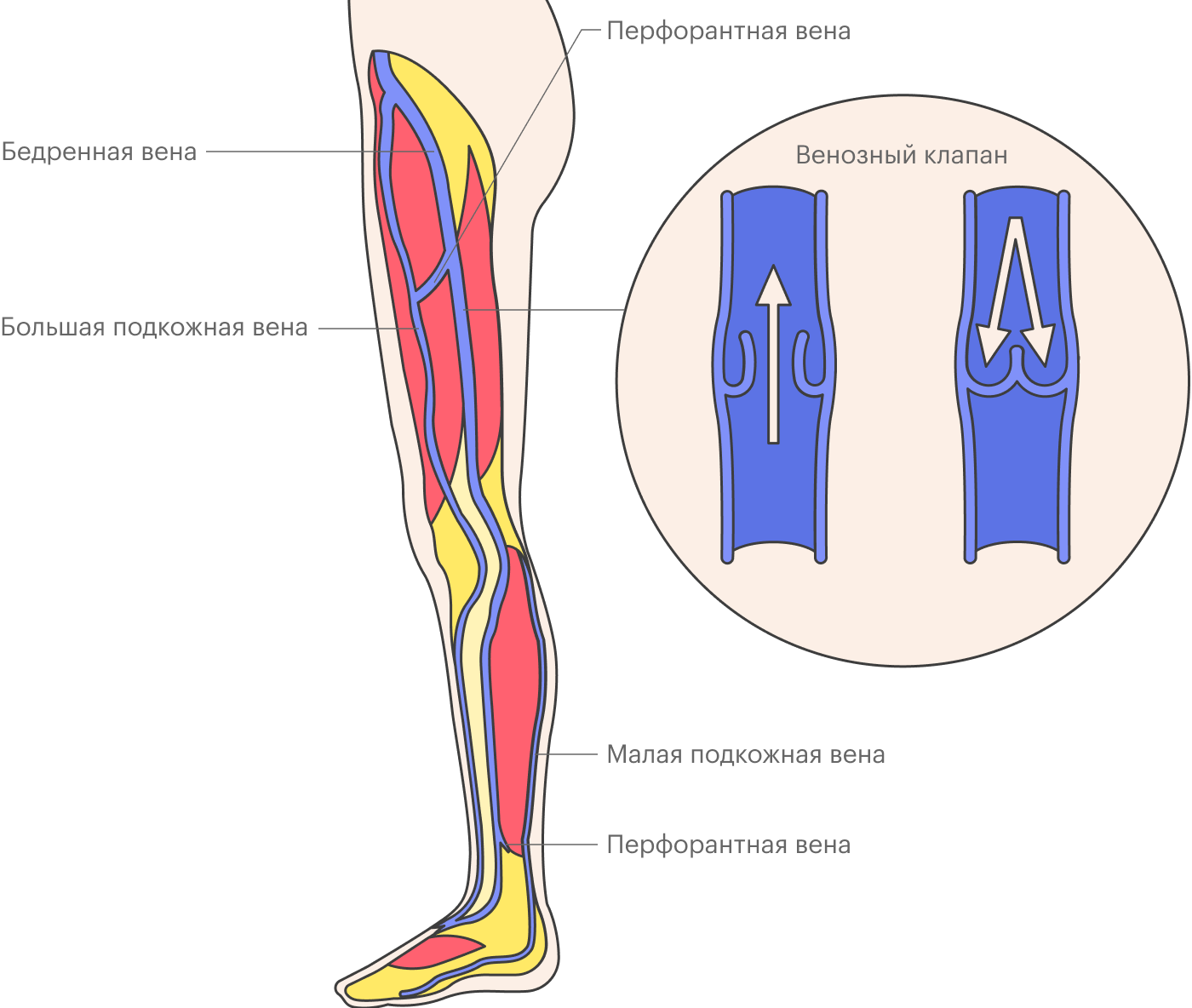 Вены ног делят на глубокие и поверхностные, они связаны перфорантными венами. Большая подкожная вена и малая подкожная вена — поверхностные вены, которые чаще всего становятся «источником» варикоза, а бедренная вена — это осевая глубокая вена. При варикозном расширении поверхностных вен происходит выброс — «утечка» крови — из глубоких вен в поверхностные в местах их соединений или по перемычкам — перфорантным венам. Также внутри вен есть клапаны, мешающие крови двигаться вниз. При варикозном расширении поверхностных вен клапаны деформируются и разрушаются, постепенно развивается венозная недостаточность. Недостаточность клапанов может быть и в глубоких венах, но встречается такое реже