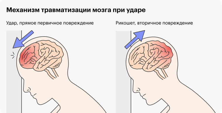 Ушиб головы у ребенка