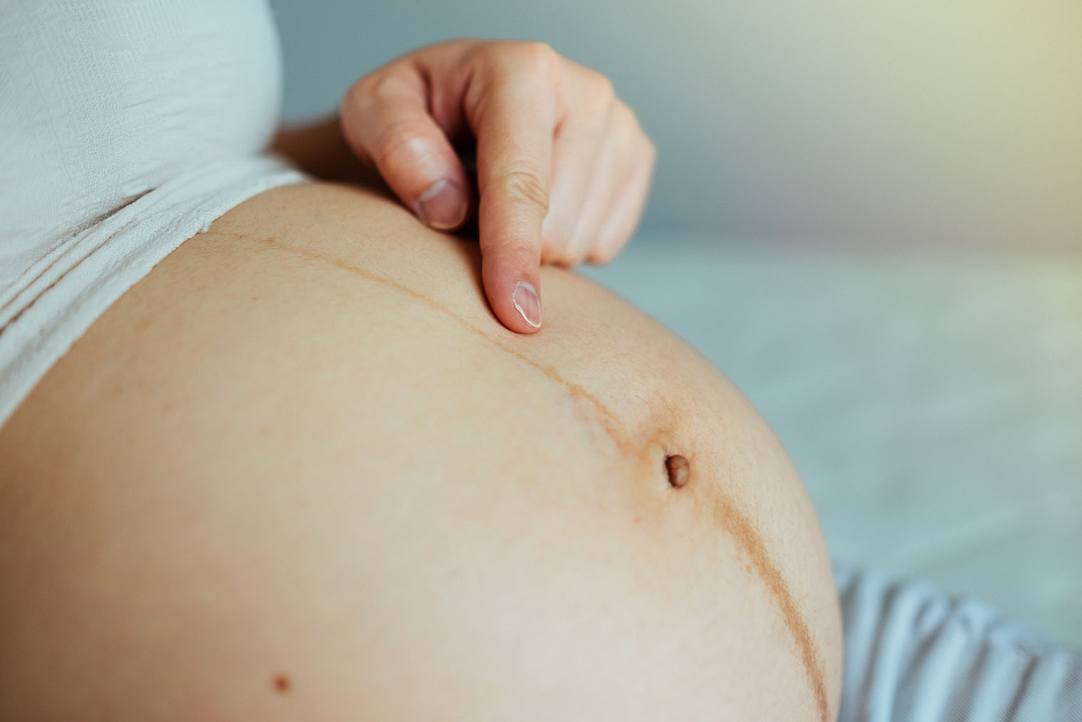 Темная вертикальная полоса на животе может начать проявляться уже в первом триместре. Исчезает в течение нескольких месяцев после родов. Фотография: MINTED VasitChaya / Shutterstock