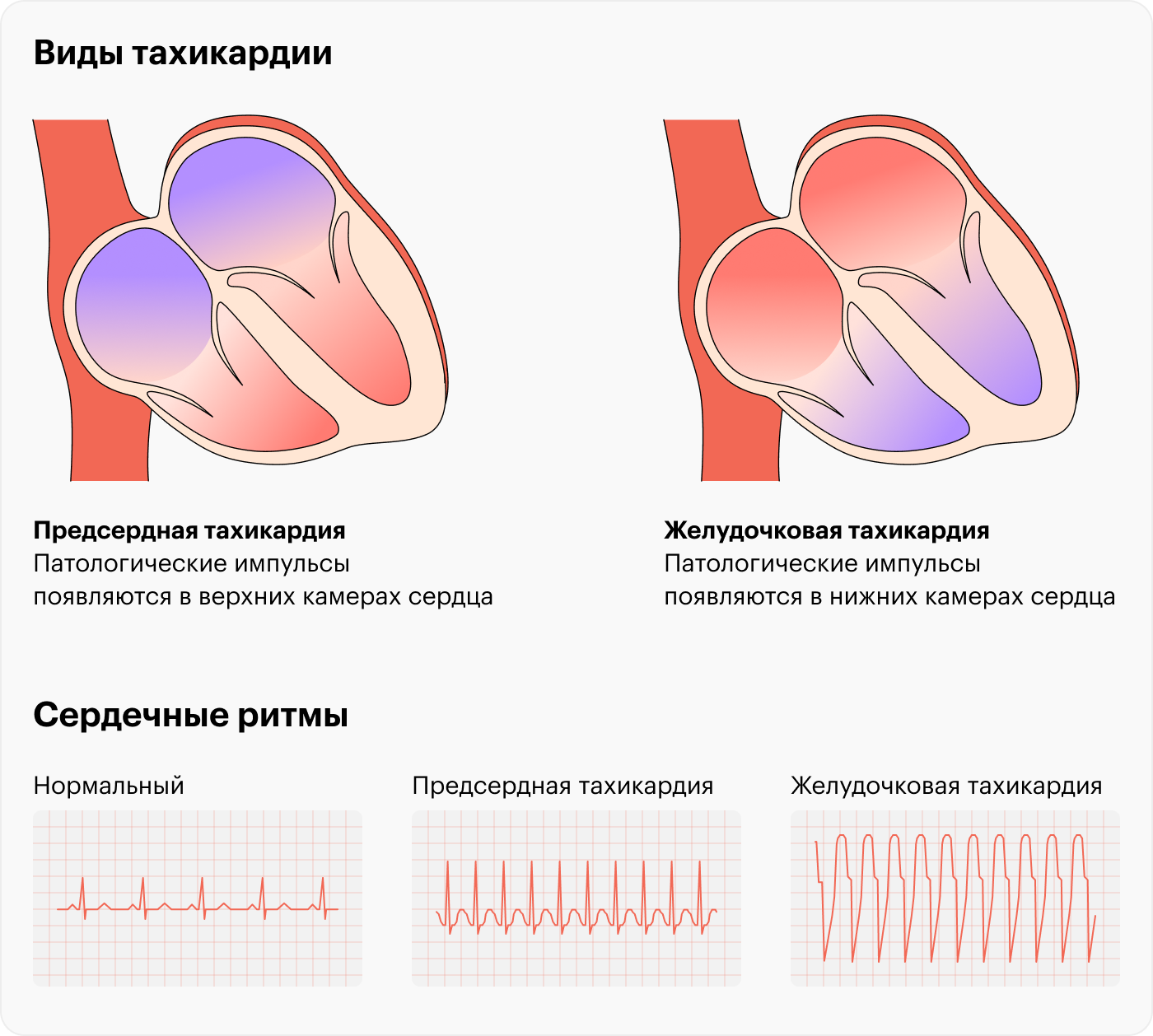 Учащенный пульс назван симптомом трех опасных заболеваний - Российская газета