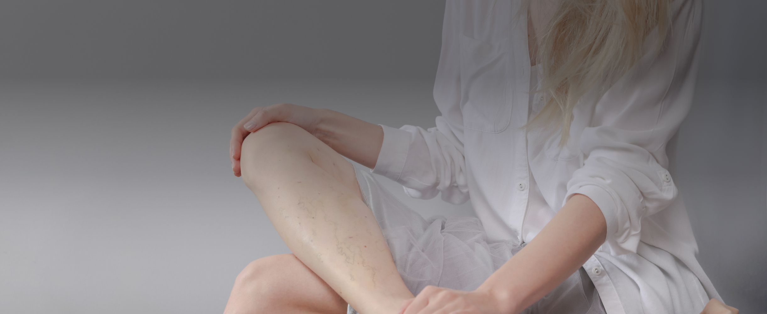 «На ноге осталось 17 шрамов»: 5 историй об удалении варикозных вен