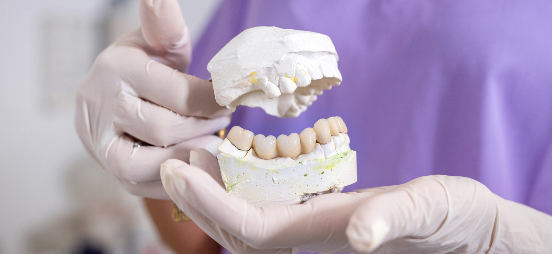 Что делать, если после зубной имплантации образовался синяк или гематома