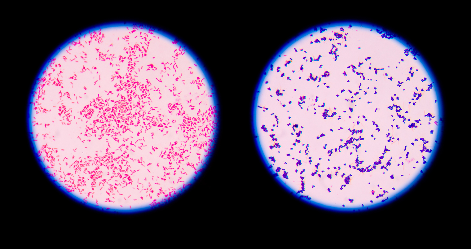 Слева — грамотрицательные бактерии, а справа — грамположительные. Источник: biologydictionary.net