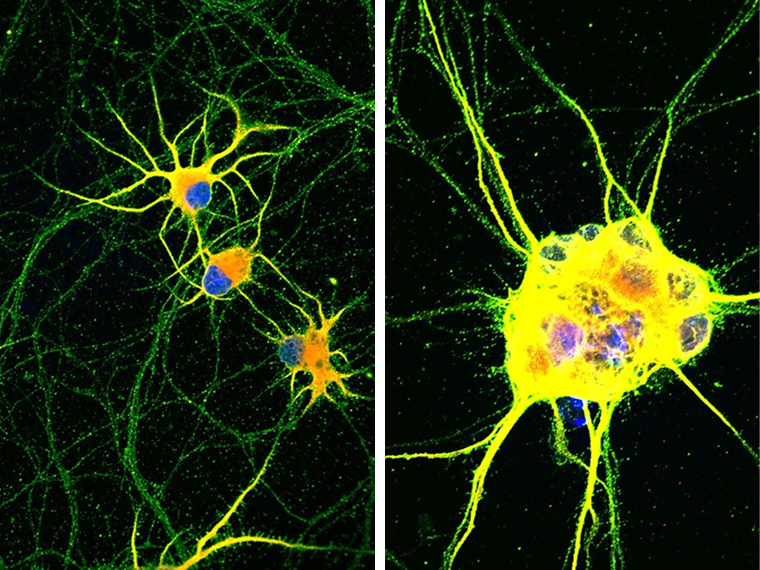 Зрелые нейроны, выращенные из iPSC. © news.northwestern.edu