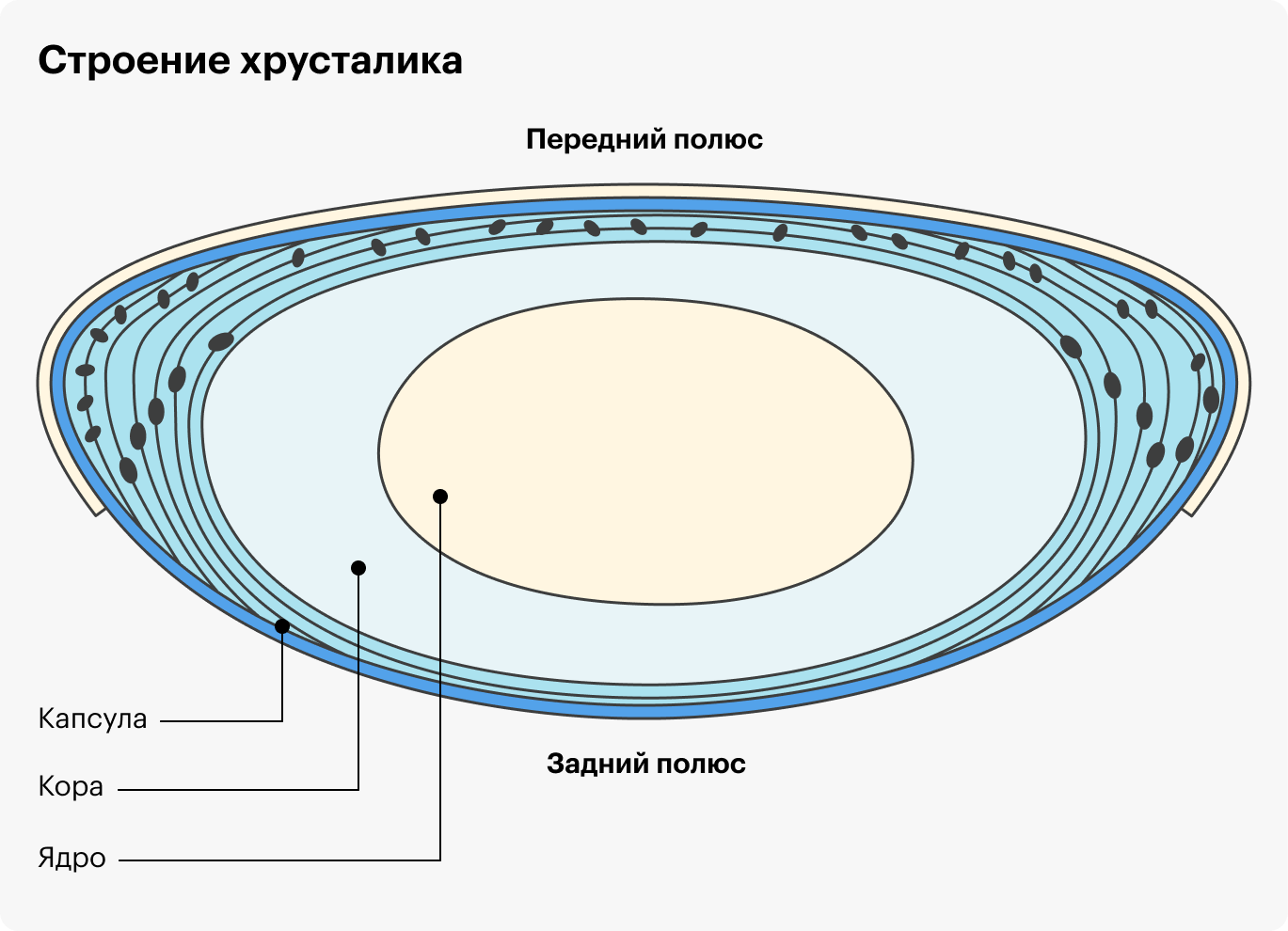 Катаракта: симптомы, причины, лечение, операция по удалению, замена  хрусталика глаза