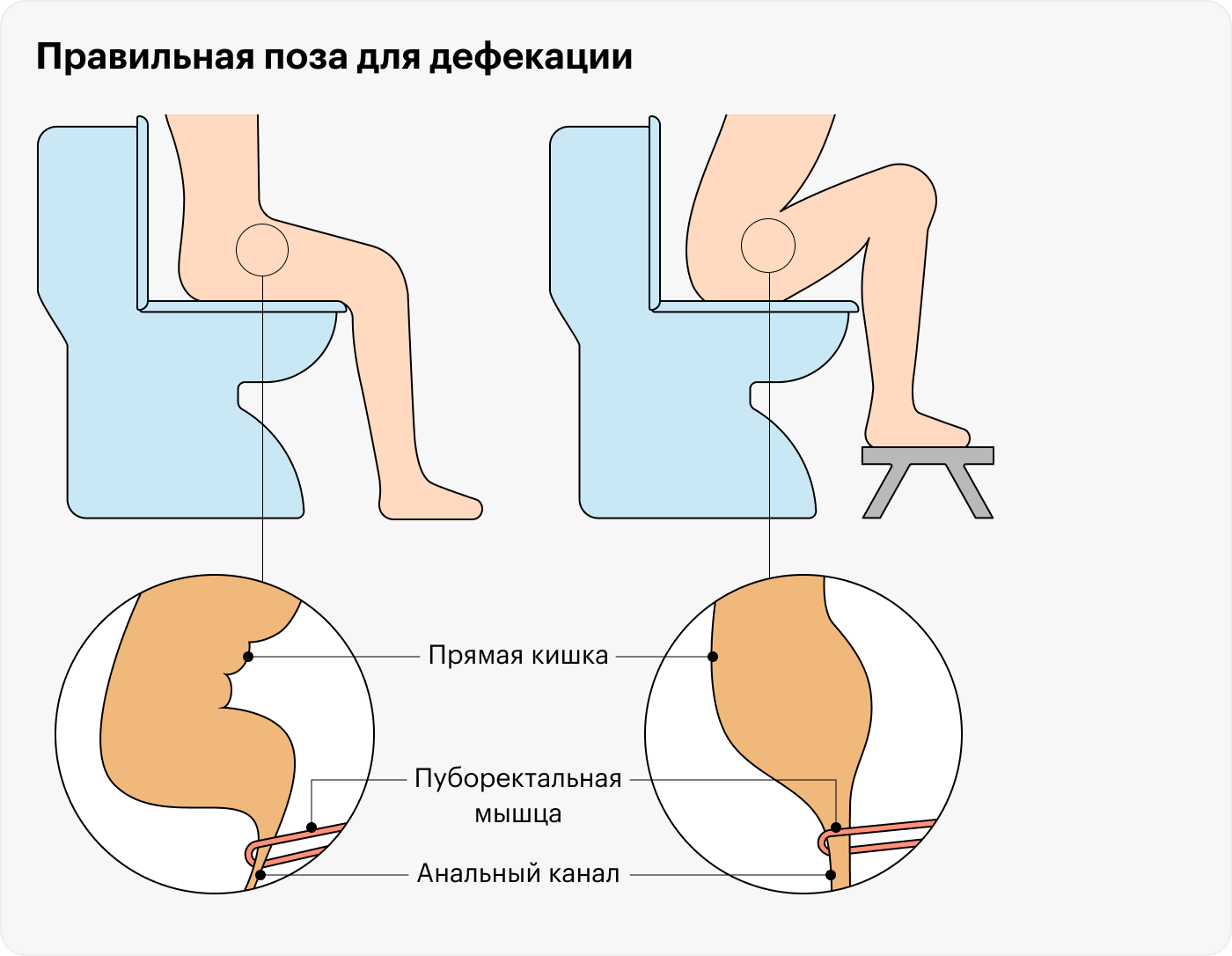 Более привычный способ сидения на унитазе не так сильно сглаживает аноректальный угол — в такой позе какать труднее, чем когда колени приподняты выше таза. Исправить это можно с помощью подножки — на «Яндекс⁠-⁠маркете» она стоит от 453 ₽