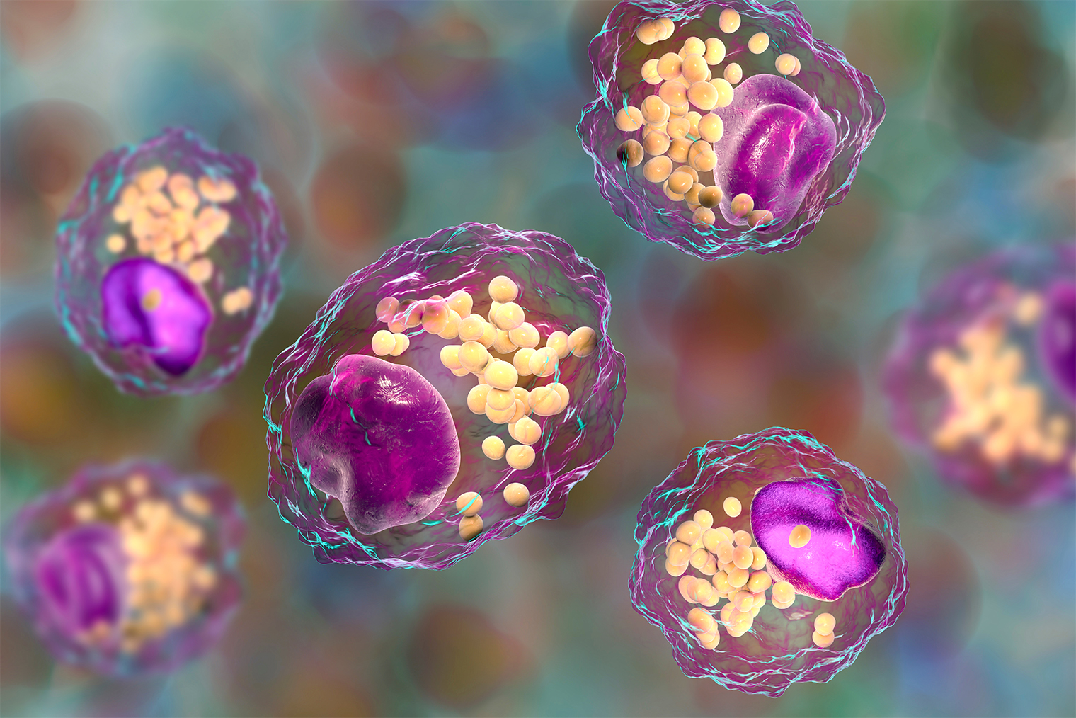 Пенистые клетки — макрофаги с крупными липидными каплями внутри. Иллюстрация: Kateryna Kon / Shutterstock / FOTODOM