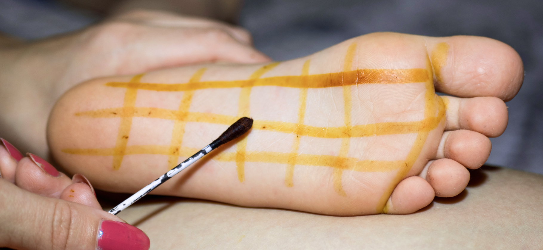 «Безумно больно и абсолютно беспо­лезно»: 13 кринжо­вых методов лечения из нашего детства