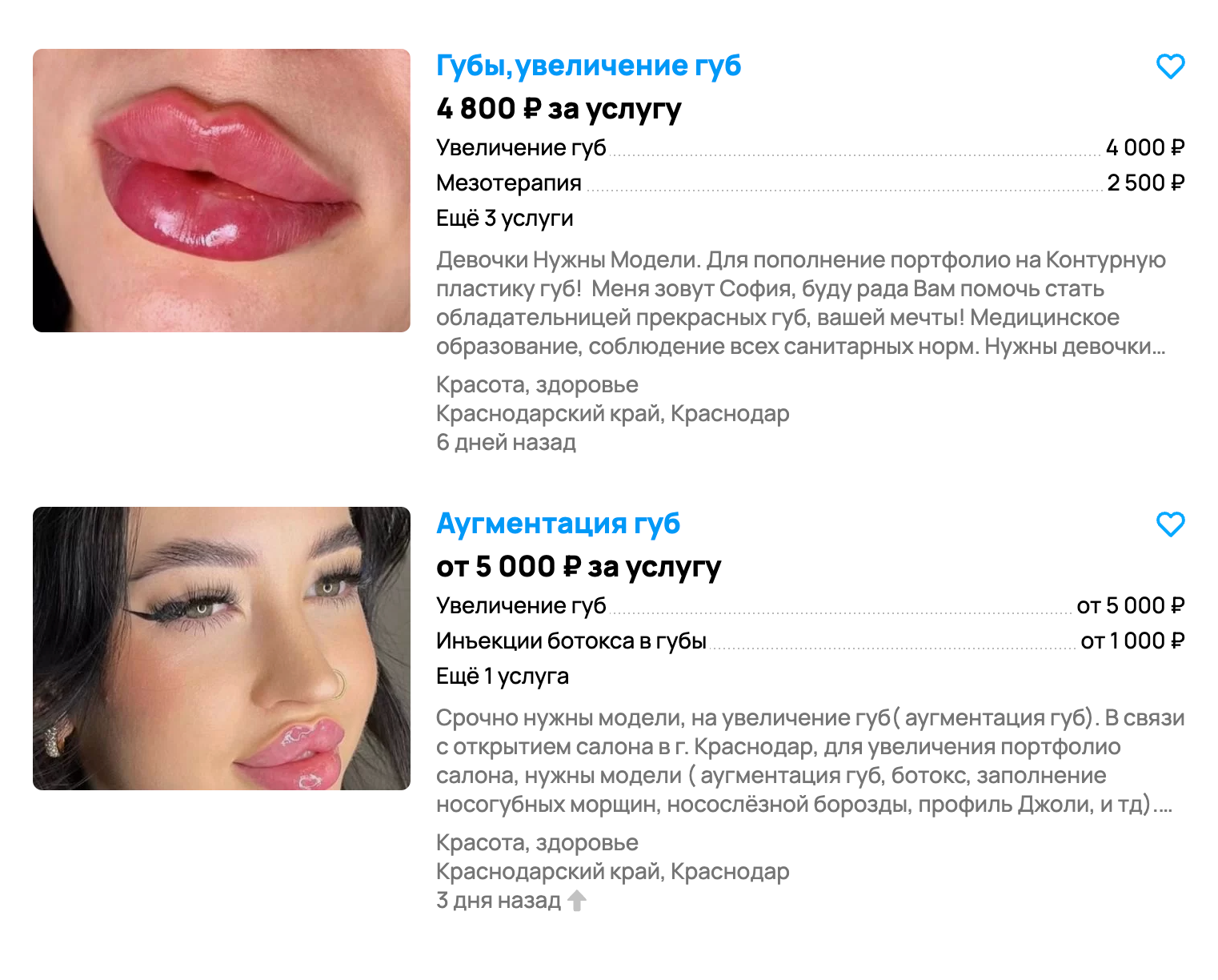 На сайтах с объявлениями сотни предложений дешевого увеличения губ. Среди них мало объявлений от квалифицированных врачей. Источник: avito.ru