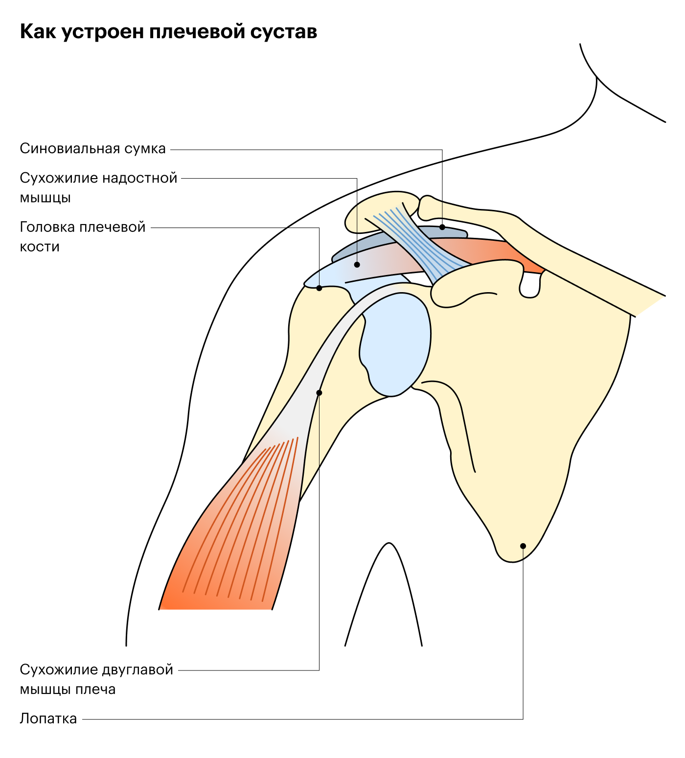 В области плеча чаще воспаляются сухожилие двуглавой мышцы, по-другому — бицепса, и сухожилие надостной мышцы. Часто эти тендиниты сочетаются друг с другом и другими проблемами плечевого сустава, например артритом