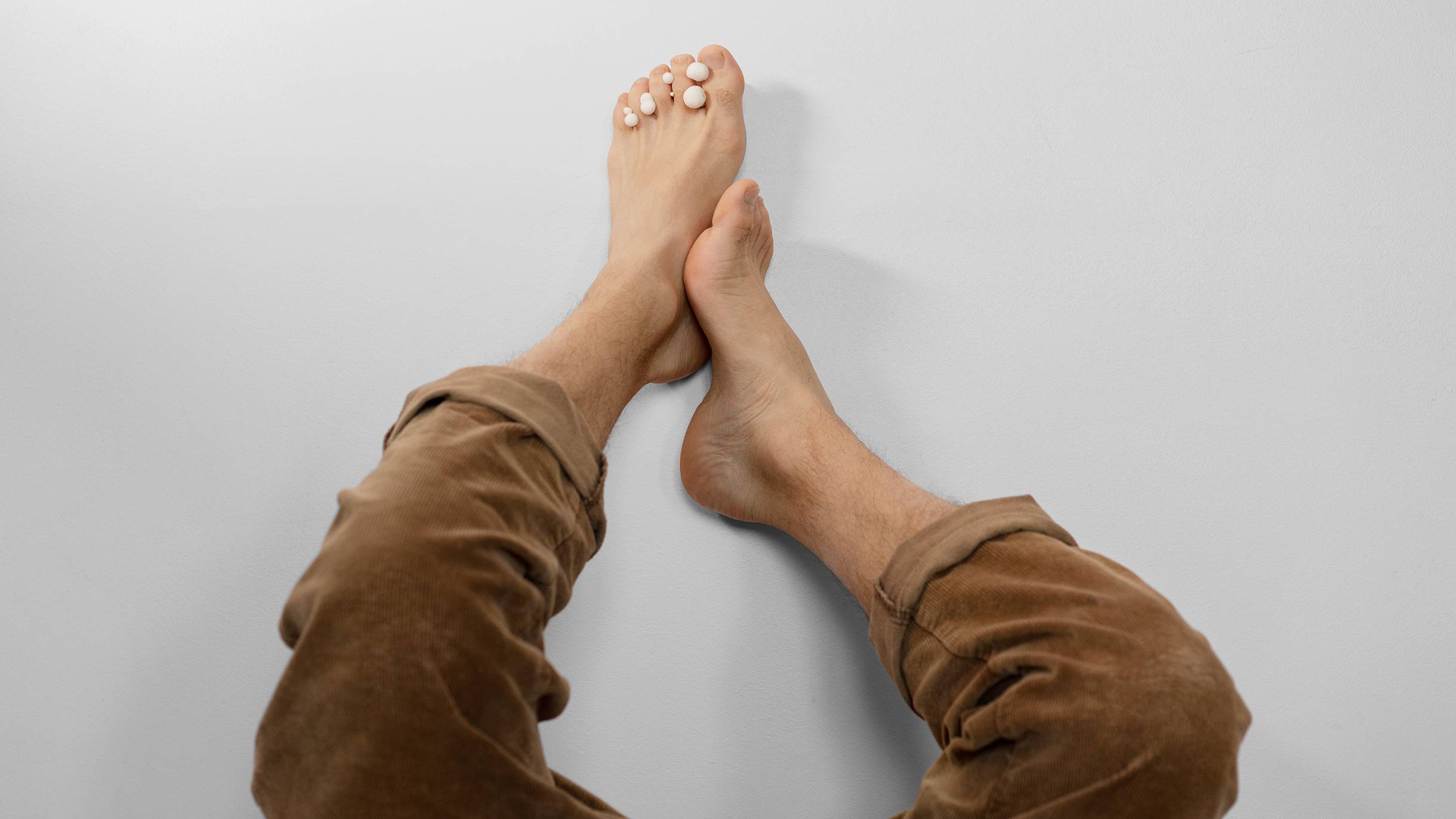 Как лечить грибок на ногах?