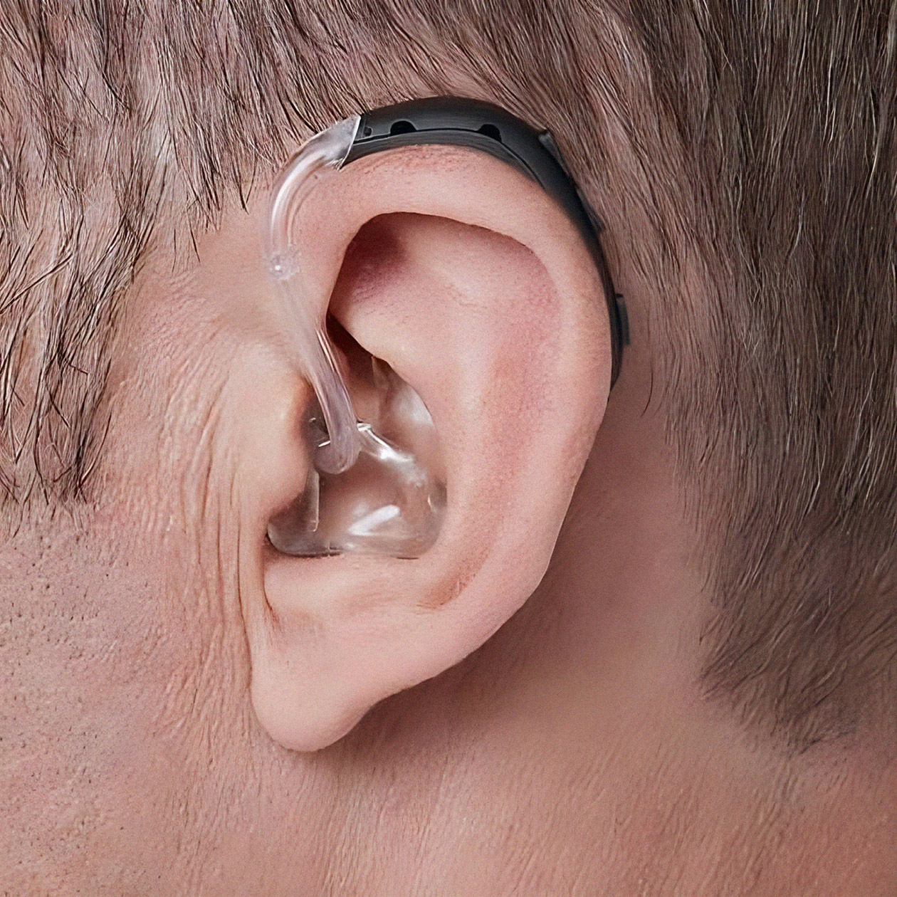 Так может выглядеть слуховой аппарат. Они бывают разными. Источник: mag-sluha.ru