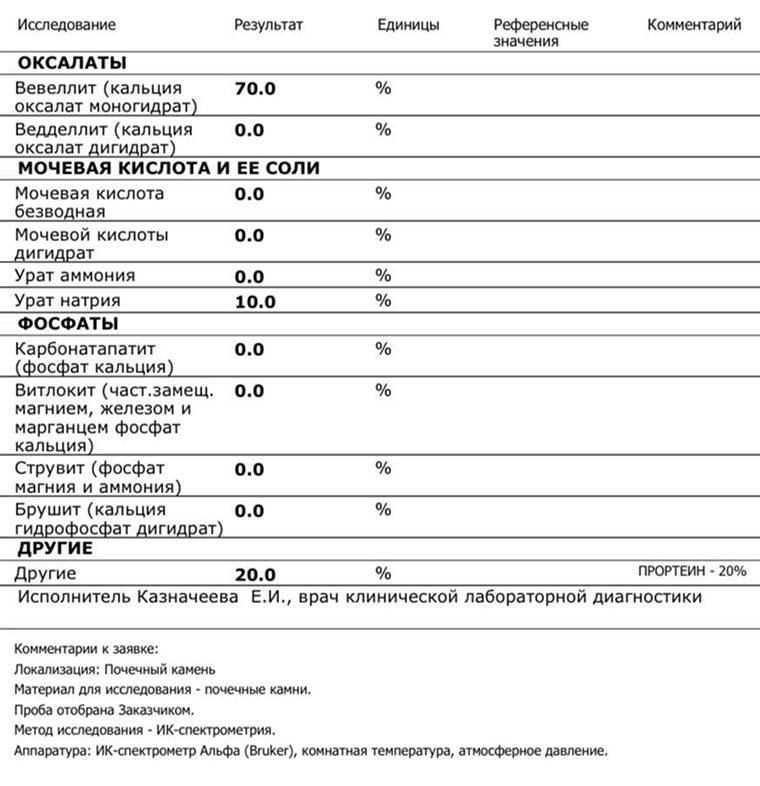 Результат инфракрасной спектрометрии почечного камня. Фотография автора
