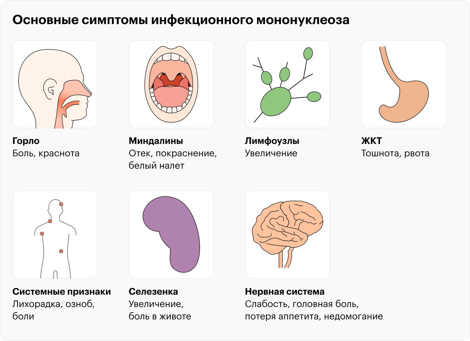 Типичные проявления мононуклеоза