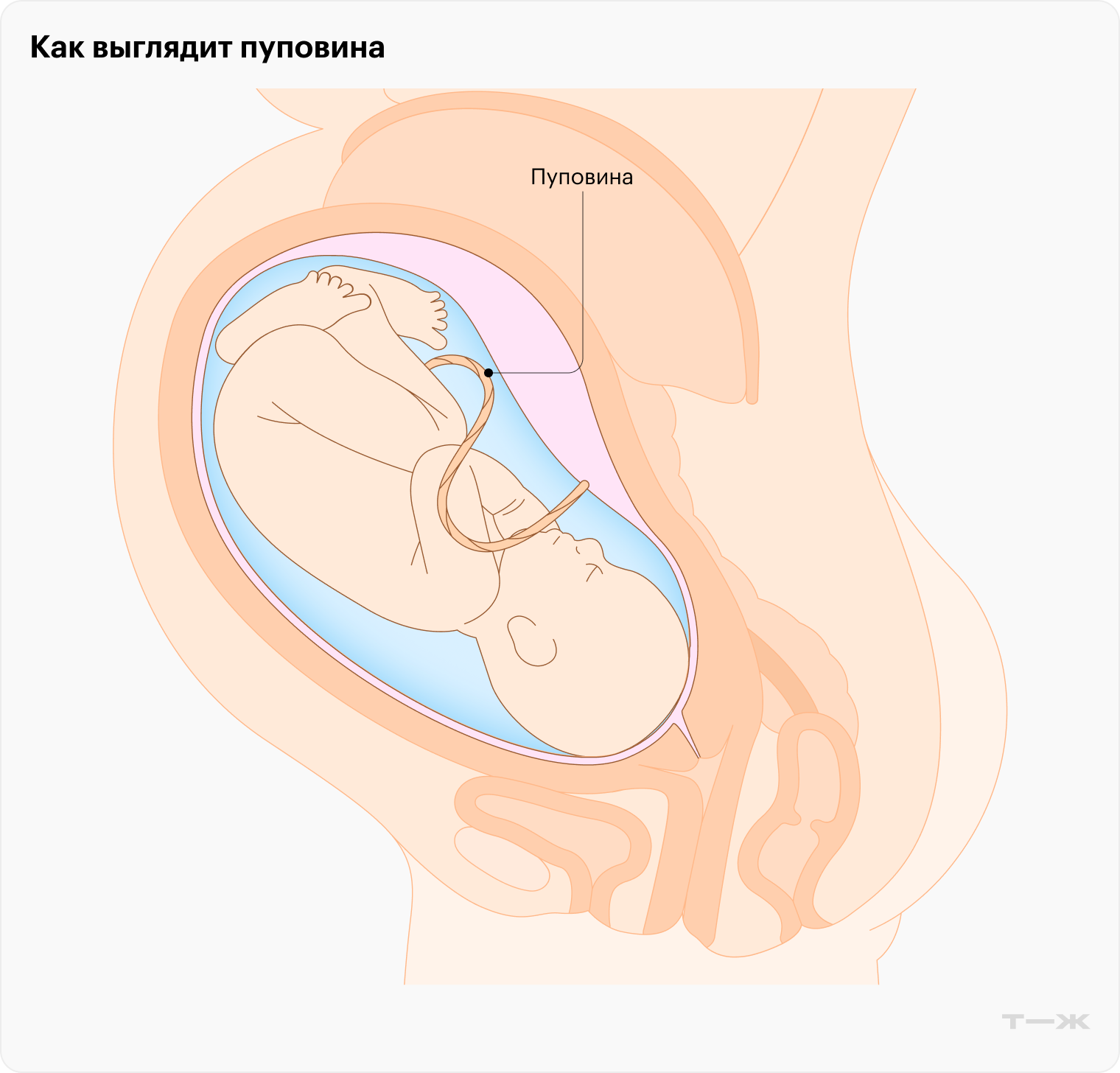 Таким канатиком — пуповиной — младенец связан с мамой, пока находится у нее в животе