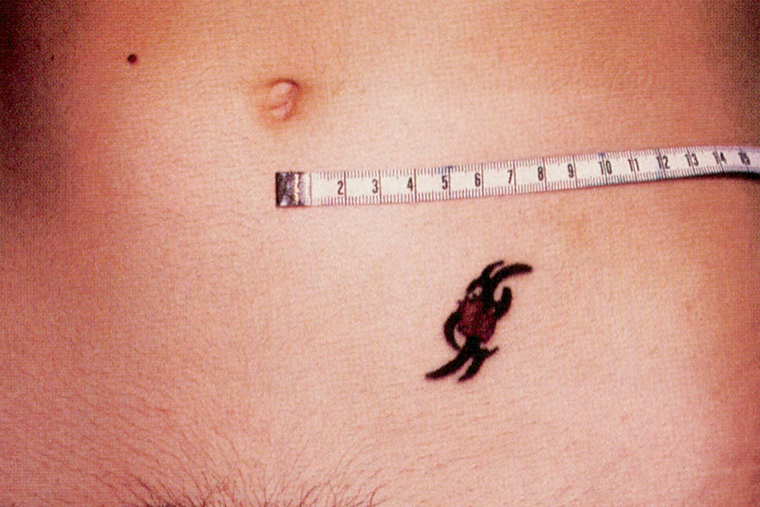 Татуировка первой пострадавшей от МРТ⁠-⁠сканирования. Источник: researchgate.net