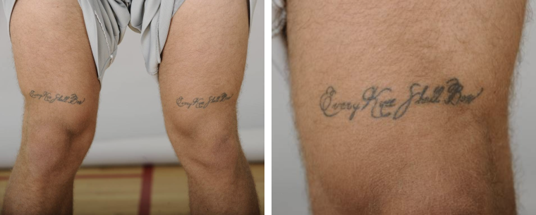 Доктор Мясников заявил, что татуировки на теле связаны с онкологией