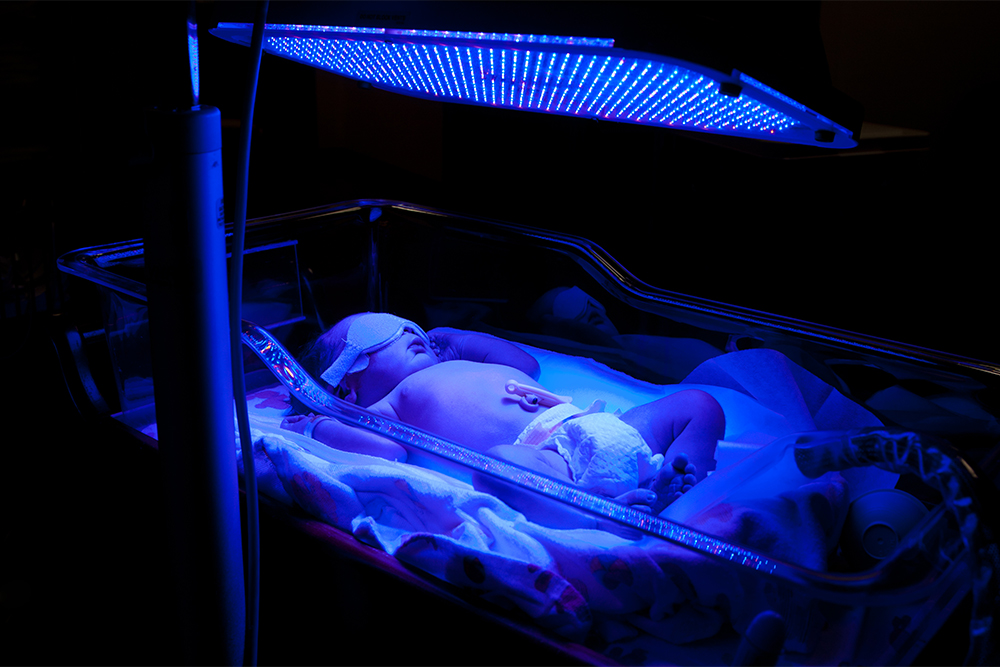 Желтуху новорожденных лечат фототерапией. Источник: Paul Hakimata Photography / Shutterstock