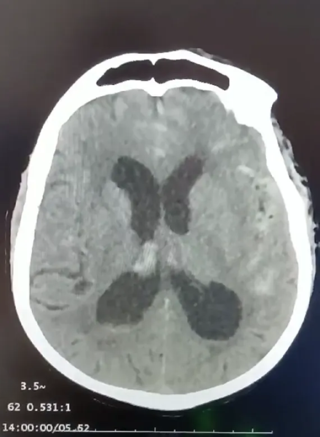 Снимок головного мозга пациента