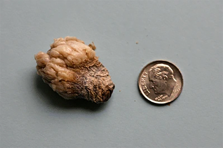Омфалолиты могут вырастать до внушительных размеров. Источник: link.springer.com