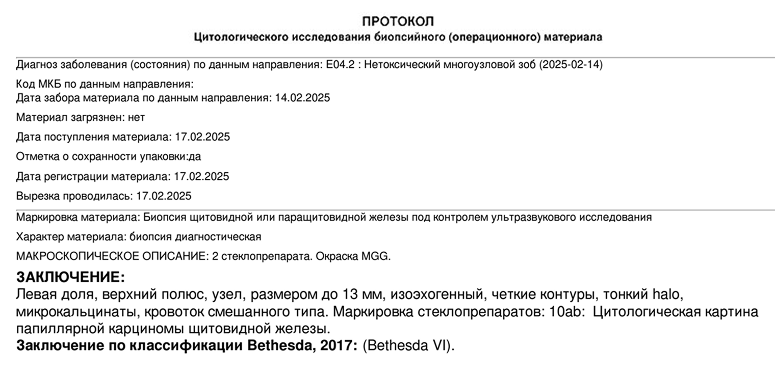 Заключение цитологического исследования — по его результатам у меня диагностировали рак