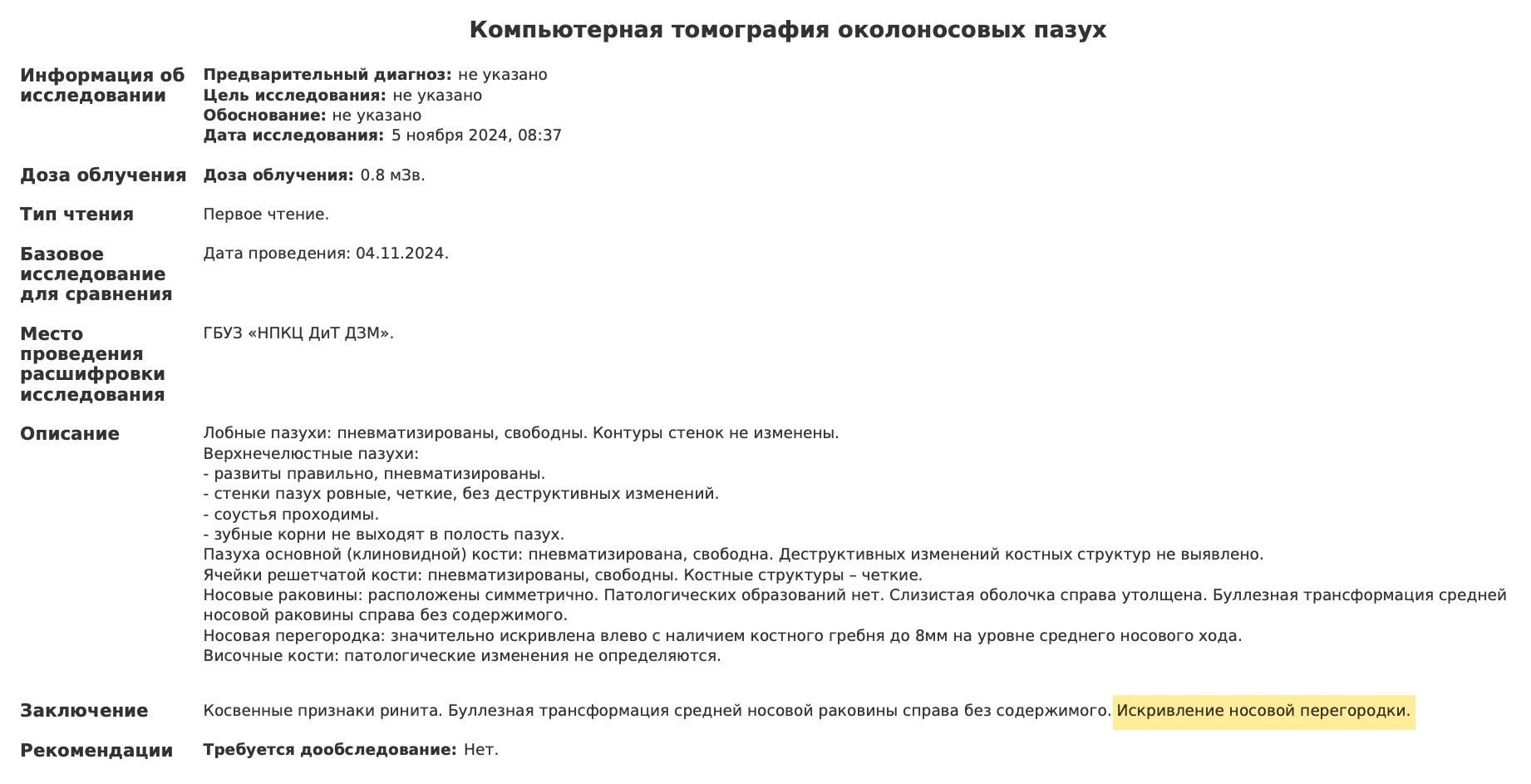 Данные КТ подтвердили искривление носовой перегородки