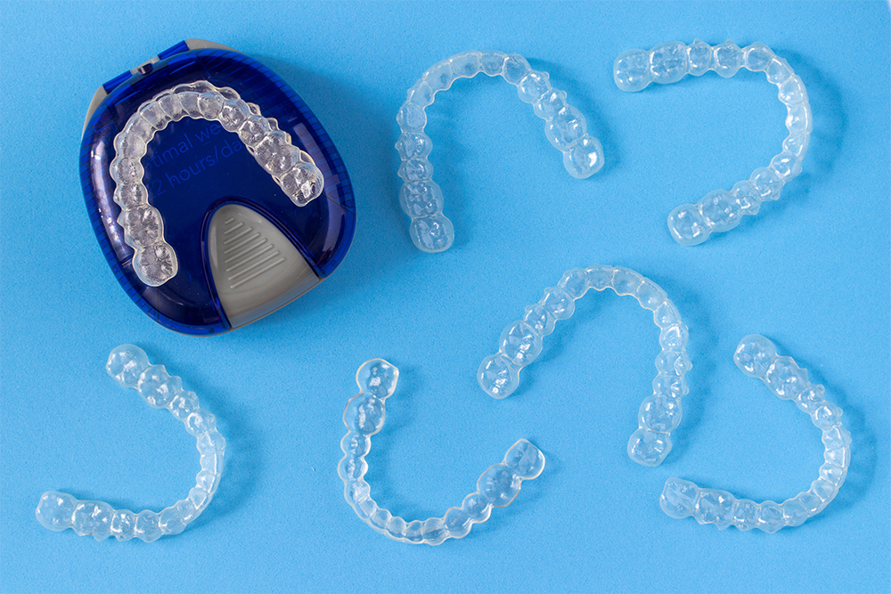 Элайнеры: съемные прозрачные капы для зубов. Источник: 1989studio / Shutterstock
