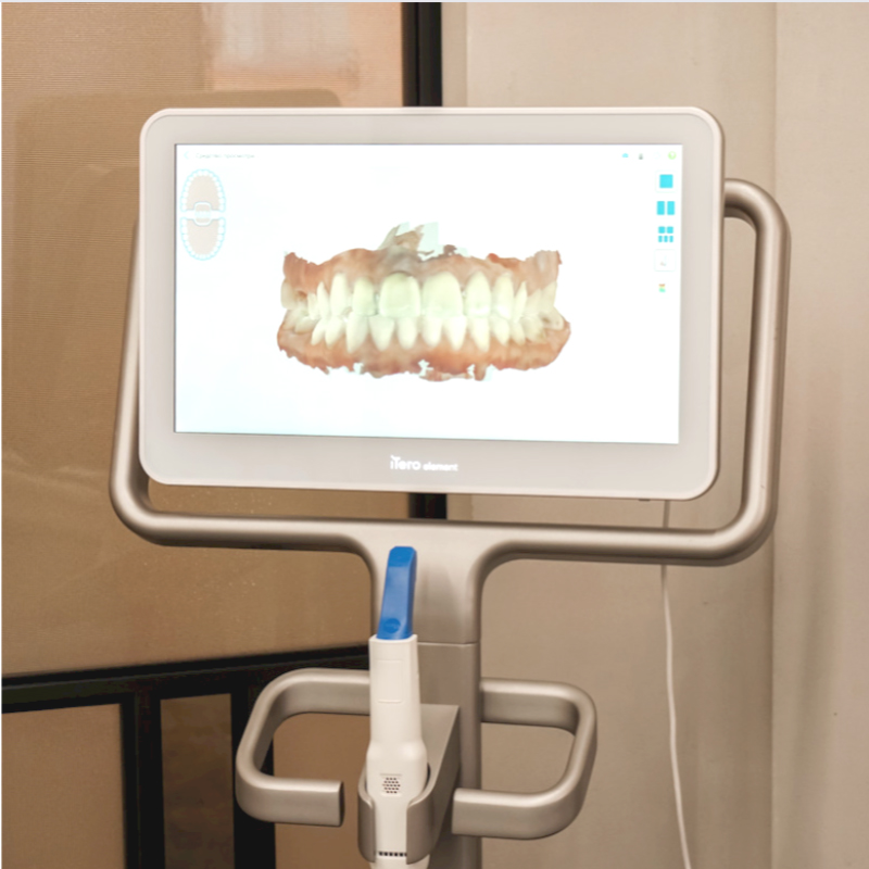 Сканирование зубных рядов на сканере iTero