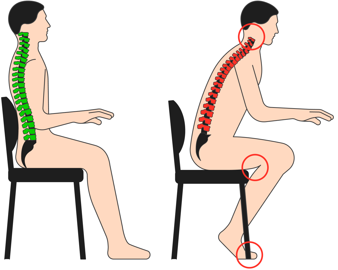 При правильной позе сохраняются все изгибы позвоночника. Напряжение в мышцах спины есть, оно распределяется вдоль всей спины и шеи. Когда мы сутулимся, грудной и поясничный изгибы сглаживаются, а шейный изгиб становится избыточным. При этом мышцы спины перенапрягаются и к концу дня будут болеть, а мышцы пресса расслабляются