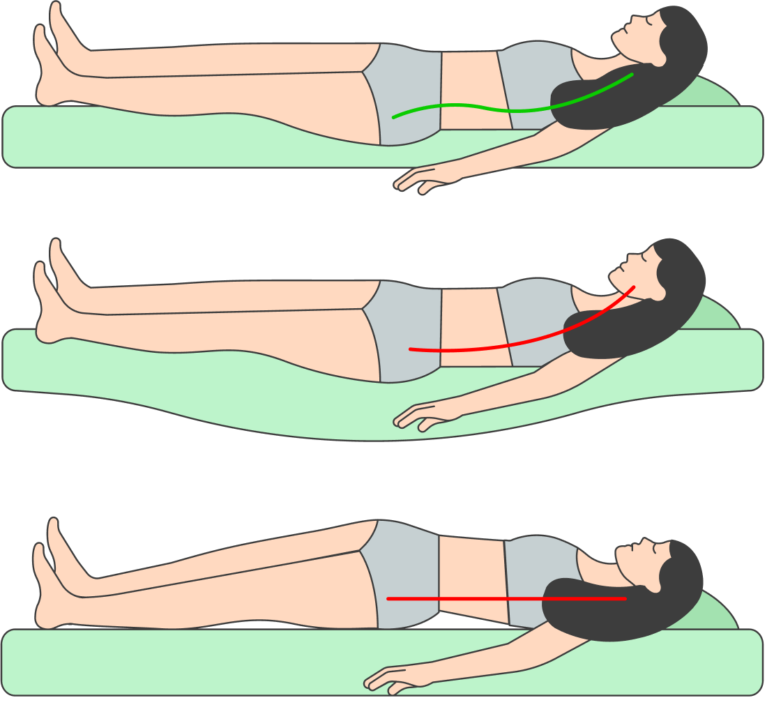 Когда человек лежит на спине, подходящий по жесткости ортопедический матрас поддерживает изгибы позвоночника в естественном положении. На мягком матрасе спина проваливается и изгибы сливаются в один. На жестком изгибы выравниваются