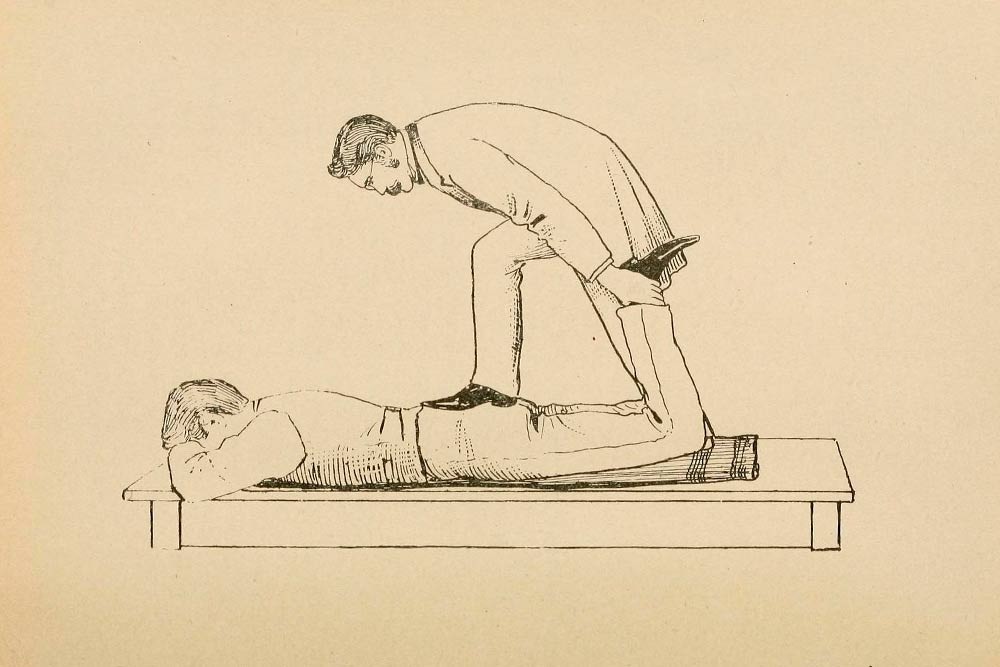 Лечение импотенции по Стиллу в 1898 году. Источник: Internet Archive