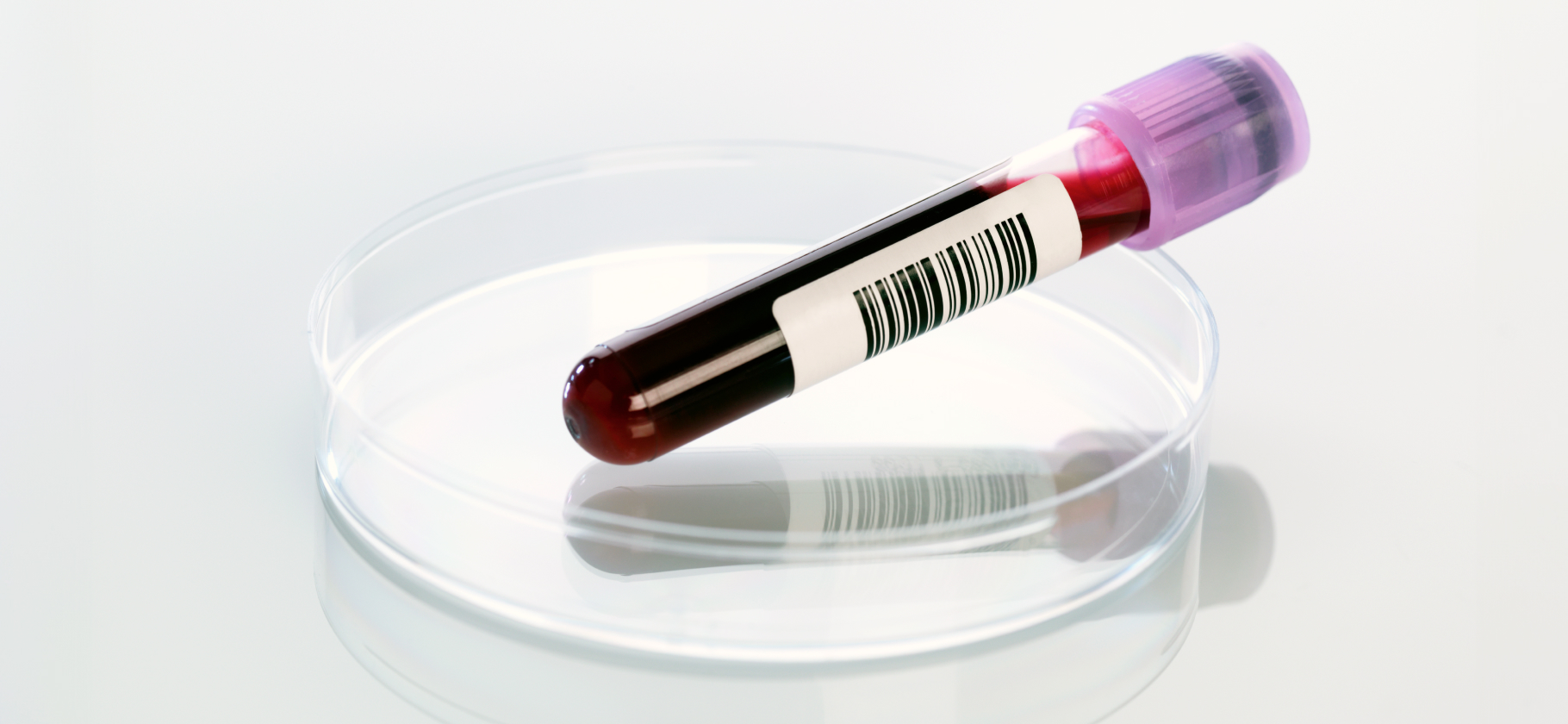 Какие анализы нужно сдать, если планируете отказаться от барьерной контрацепции