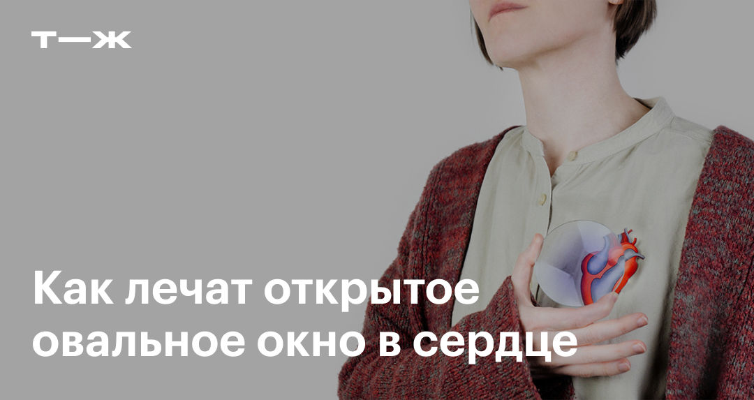 Как лечат открытое овальное окно в сер­дце и нужна ли ​опе­рация